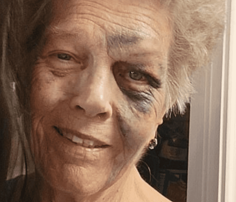 GoFundMe photo of beaten grandmother