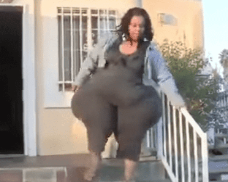 Woman Proud of Whopping 8ft Hips (video)
